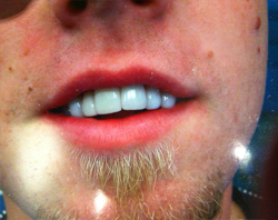 The image shows a close-up of a person with facial hair, wearing sunglasses, displaying a smile with teeth showing, against a blurred background.