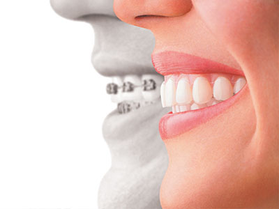 The image features a split-screen of two individuals with their mouths open, showcasing dental implants on either side.