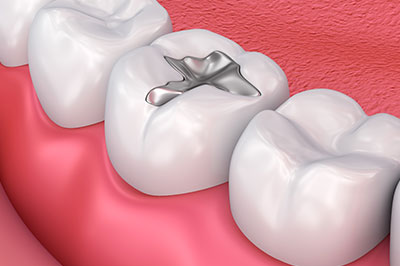 The image features a close-up view of a human dental implant integrated into a natural tooth with surrounding gum tissue, set against a pink background that resembles a mouth interior.