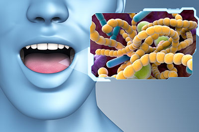 The image features a 3D rendering of a human head with an open mouth, displaying a yellowish-green substance resembling bacteria or microorganisms, with a sign that reads  Bacteria  in the background.