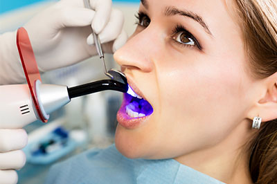 A woman seated in a dental chair with a dental hygienist performing a cleaning procedure using an ultrasonic scaler, focusing on her teeth.