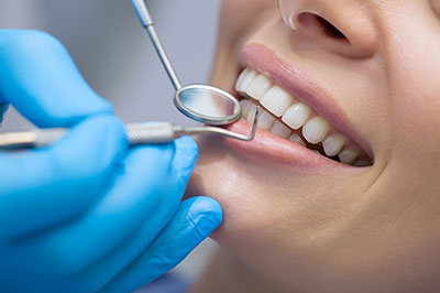 The image shows a dental professional performing a teeth cleaning procedure on a patient s mouth, with the patient wearing a blue surgical mask and having their teeth worked on by the professional, who is using a specialized tool.