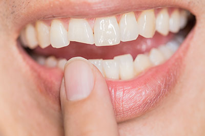 The image shows a close-up view of an individual s teeth with a partial smile, focusing on the teeth and gums, with a finger holding a toothpaste tablet near the mouth.