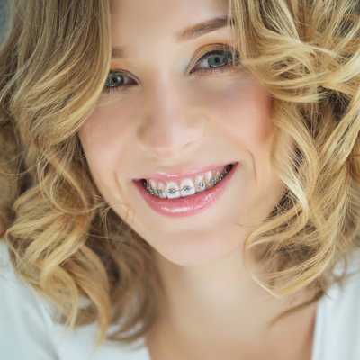 A young woman with braces smiling at the camera.