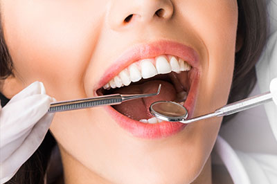 A woman with a wide smile holds her mouth open while dental tools are inserted into her teeth by a professional in a white coat, all set against a clean, clinical background.